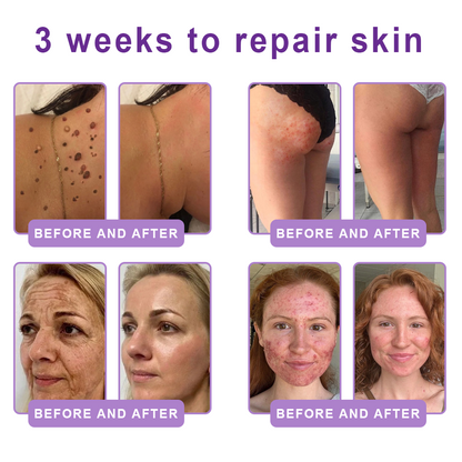𝐇𝐈𝐒𝐊𝐈𝐍® 𝐏𝐃𝐑𝐍 𝐌𝐮𝐥𝐭𝐢-𝐏𝐞𝐩𝐭𝐢𝐝𝐞 𝐌𝐚𝐬𝐬𝐚𝐠𝐢𝐧𝐠 𝐁𝐨𝐝𝐲 𝐑𝐨𝐥𝐥𝐞𝐫 𝐂𝐫𝐞𝐚𝐦- 𝐀𝐧𝐭𝐢-𝐚𝐠𝐢𝐧𝐠, 𝐇𝐲𝐝𝐫𝐚𝐭𝐢𝐧𝐠, 𝐒𝐤𝐢𝐧 𝐅𝐢𝐫𝐦𝐢𝐧𝐠 & 𝐋𝐢𝐟𝐭𝐢𝐧𝐠, 𝐒𝐤𝐢𝐧 𝐑𝐞𝐩𝐚𝐢𝐫, 𝐄𝐯𝐞𝐧 𝐓𝐨𝐧𝐞, 𝐀𝐜𝐧𝐞 𝐚𝐧𝐝 𝐃𝐚𝐫𝐤 𝐒𝐩𝐨𝐭 𝐓𝐫𝐞𝐚𝐭𝐦𝐞𝐧𝐭, 𝐖𝐚𝐫𝐭 𝐚𝐧𝐝 𝐌𝐨𝐥𝐞 𝐑𝐞𝐦𝐨𝐯𝐚𝐥, 𝐚𝐧𝐝 𝐏𝐬𝐨𝐫𝐢𝐚𝐬𝐢𝐬 𝐑𝐞𝐥𝐢𝐞𝐟.