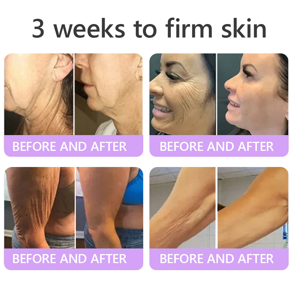 𝐇𝐈𝐒𝐊𝐈𝐍® 𝐏𝐃𝐑𝐍 𝐌𝐮𝐥𝐭𝐢-𝐏𝐞𝐩𝐭𝐢𝐝𝐞 𝐌𝐚𝐬𝐬𝐚𝐠𝐢𝐧𝐠 𝐁𝐨𝐝𝐲 𝐑𝐨𝐥𝐥𝐞𝐫 𝐂𝐫𝐞𝐚𝐦- 𝐀𝐧𝐭𝐢-𝐚𝐠𝐢𝐧𝐠, 𝐇𝐲𝐝𝐫𝐚𝐭𝐢𝐧𝐠, 𝐒𝐤𝐢𝐧 𝐅𝐢𝐫𝐦𝐢𝐧𝐠 & 𝐋𝐢𝐟𝐭𝐢𝐧𝐠, 𝐒𝐤𝐢𝐧 𝐑𝐞𝐩𝐚𝐢𝐫, 𝐄𝐯𝐞𝐧 𝐓𝐨𝐧𝐞, 𝐀𝐜𝐧𝐞 𝐚𝐧𝐝 𝐃𝐚𝐫𝐤 𝐒𝐩𝐨𝐭 𝐓𝐫𝐞𝐚𝐭𝐦𝐞𝐧𝐭, 𝐖𝐚𝐫𝐭 𝐚𝐧𝐝 𝐌𝐨𝐥𝐞 𝐑𝐞𝐦𝐨𝐯𝐚𝐥, 𝐚𝐧𝐝 𝐏𝐬𝐨𝐫𝐢𝐚𝐬𝐢𝐬 𝐑𝐞𝐥𝐢𝐞𝐟.